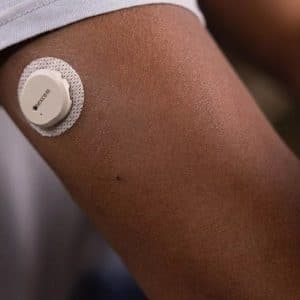 Close-up of a person's upper arm with a Dexcom sensor attached to the skin, providing real-time blood sugar monitoring. The sensor is secured with adhesive tape, and the background is slightly blurred, focusing attention on the device.